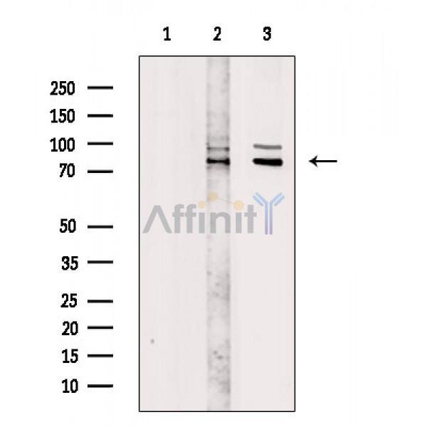 Валидация Affinity DF2369 - 12947