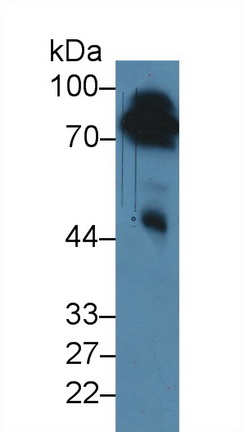 12476