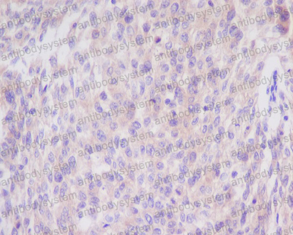Валидация AntibodySystem RHA69701 (189)