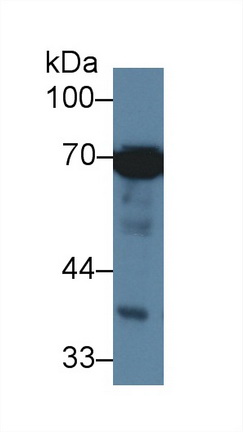 14678