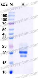 EHA05902, SDS-PAGE