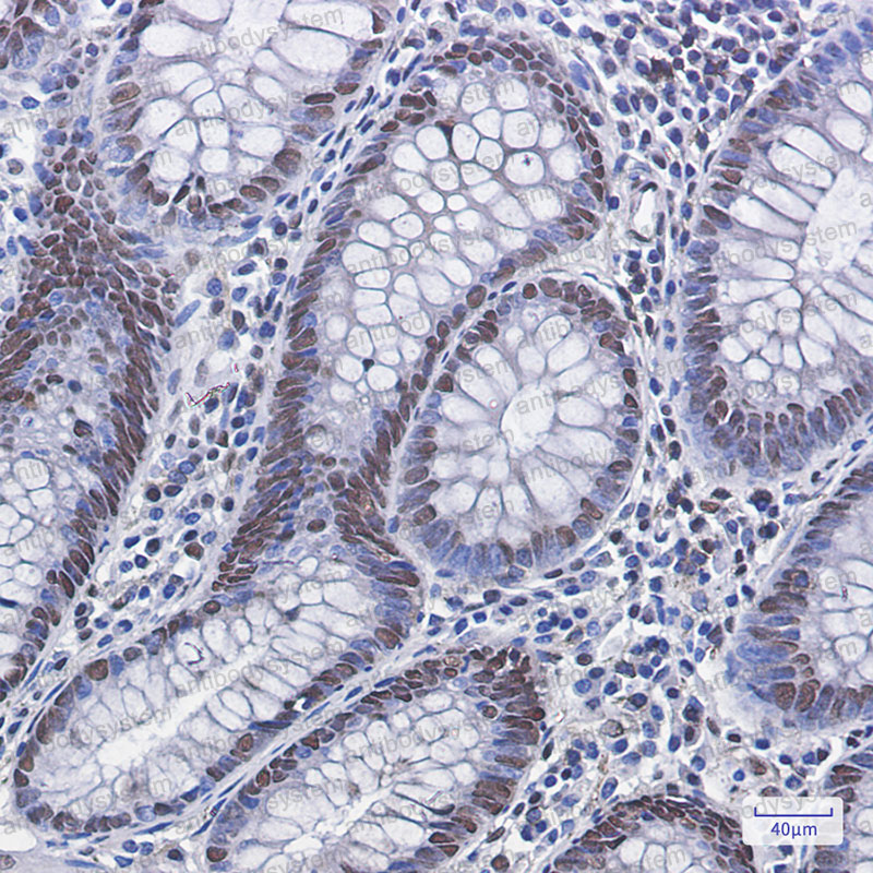 Валидация AntibodySystem RHF84501