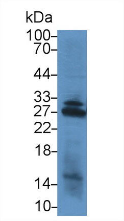 14611