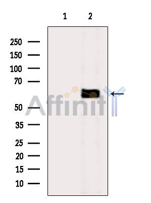 Валидация Affinity AF6795 - 4036