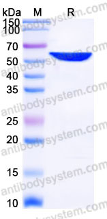 YHD05403, SDS-PAGE