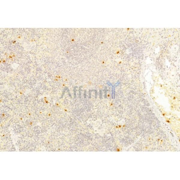 Валидация Affinity DF6556 - 17995