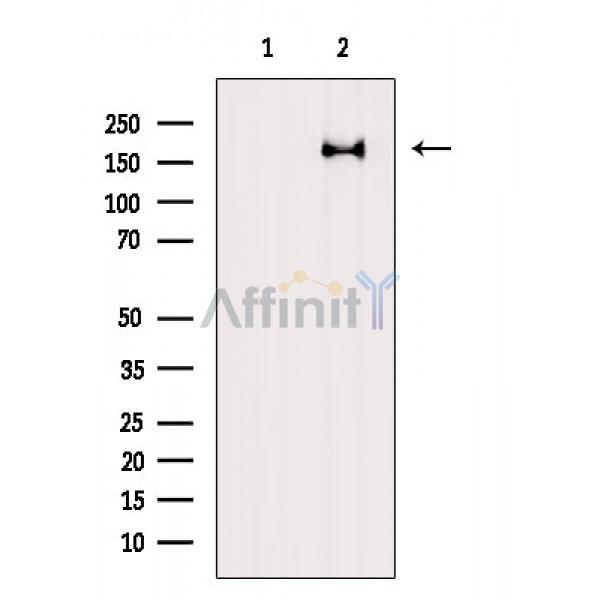 Валидация Affinity AF6564 - 3870