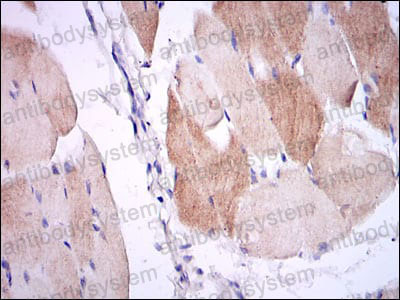 Валидация AntibodySystem RHB95601 (476)