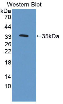 57320