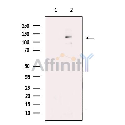 Валидация Affinity AF6022 - 3216