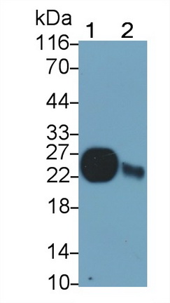 39218