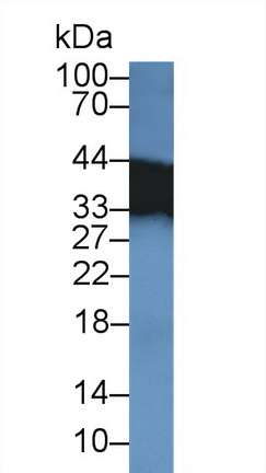 14432