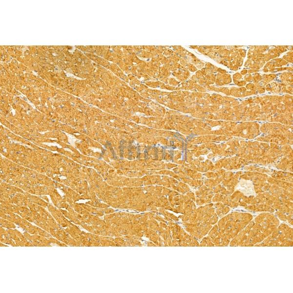 Валидация Affinity DF12021 - 6038