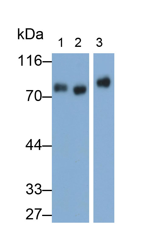 31819