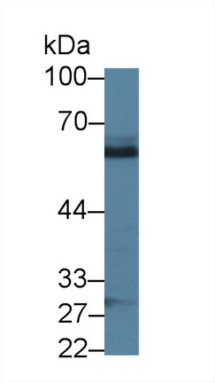14396
