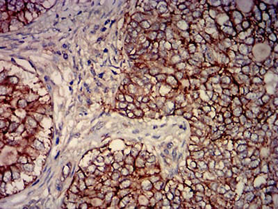 Валидация AntibodySystem RHD11902 (1341)