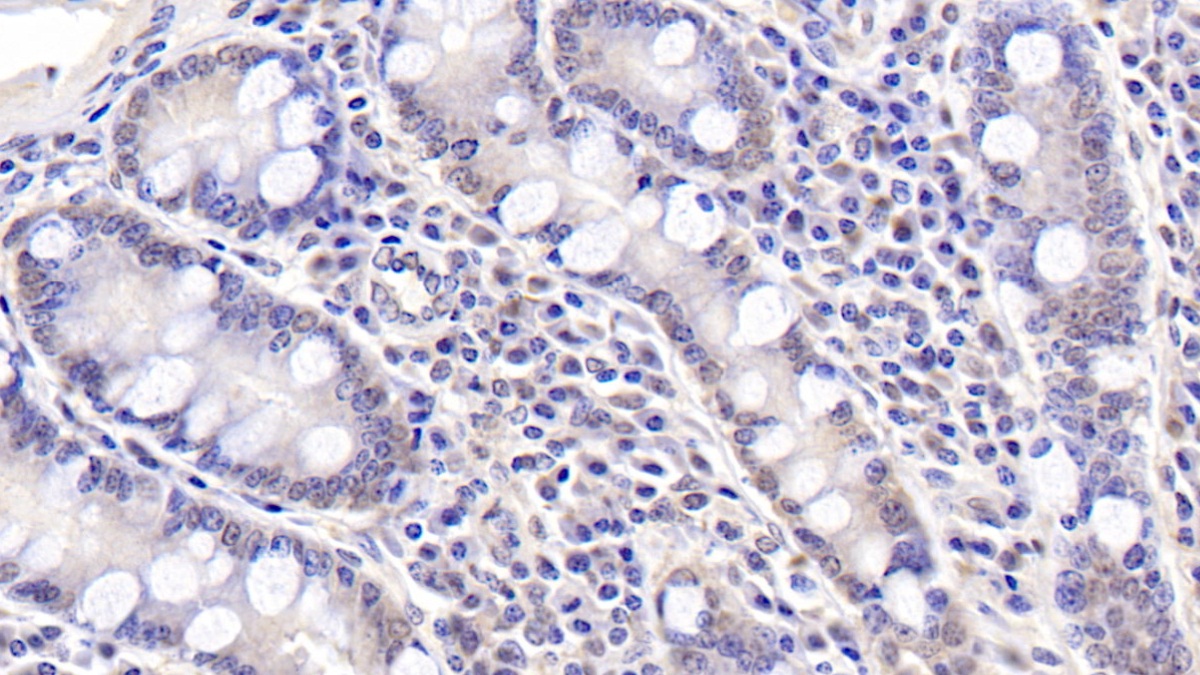 19570