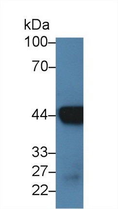 14216