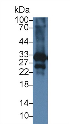 14920