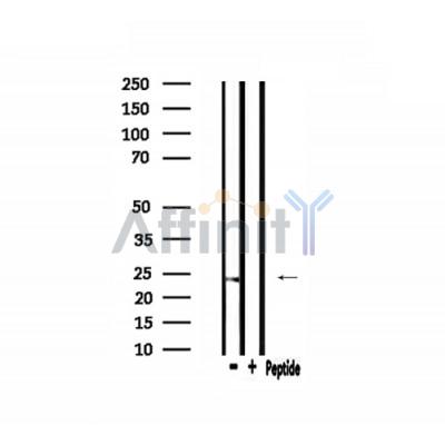 Валидация Affinity DF3601 - 14567