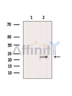 Валидация Affinity DF14909 - 11069