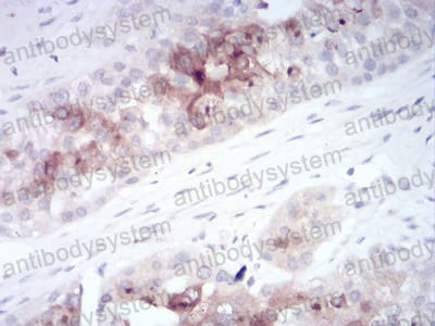 Валидация AntibodySystem RHN94502