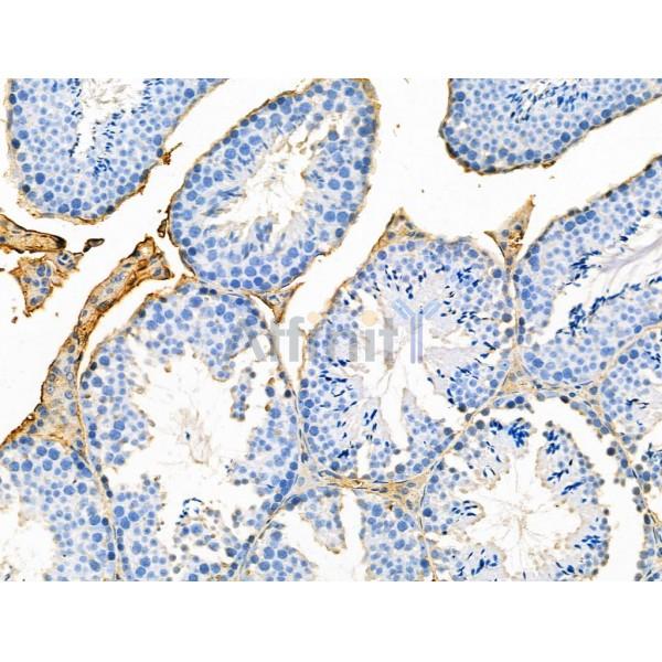 Валидация Affinity AF5246 - 2742