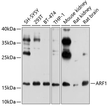 Валидация Elabscience E-AB-92372