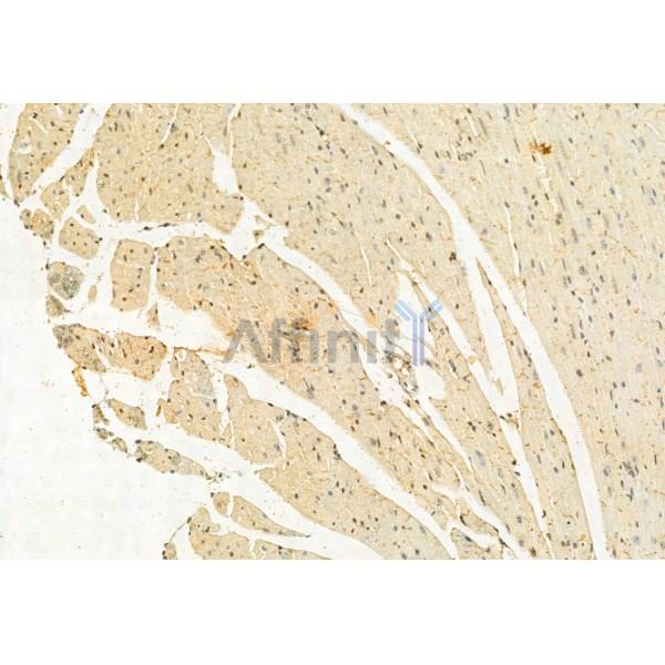 Валидация Affinity DF12057 - 6114