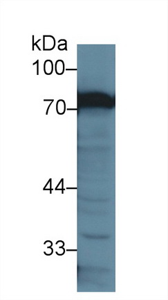 13038