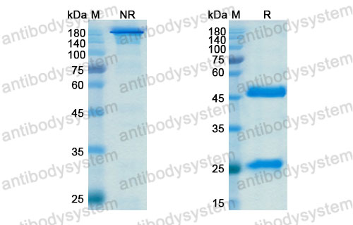 Валидация SDS-PAGE - AntibodySystem DHB74002