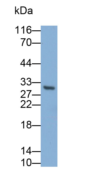 30995