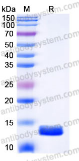 EHC01801, SDS-PAGE