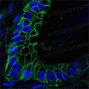 Валидация IF - AntibodySystem RHD14802 (541)