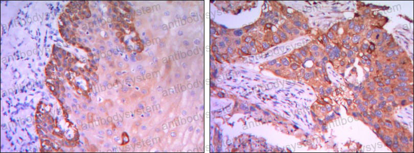Валидация AntibodySystem RHF23401