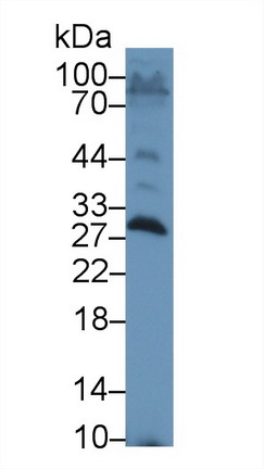 9584