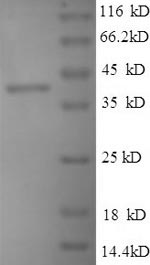 SDS-PAGE