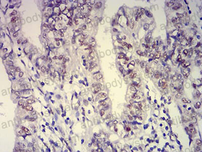 Валидация AntibodySystem RHF02504 (2422)