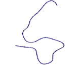 Alpha-2-Heremans Schmid Glycoprotein (aHSG)