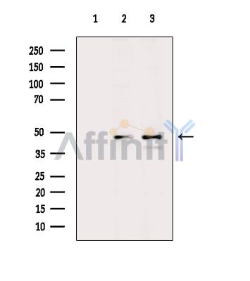 Валидация Affinity DF13853 - 9562