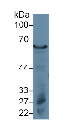 13014