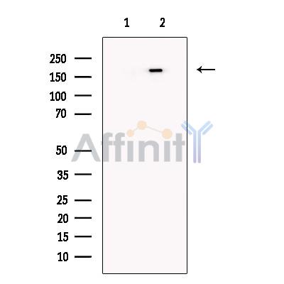 Валидация Affinity DF13631 - 9165