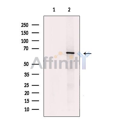 Валидация Affinity DF6361 - 17711