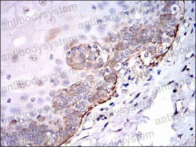 Валидация AntibodySystem RHC95705