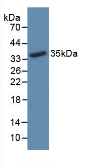 17710