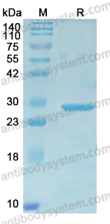 YVV38601, SDS-PAGE