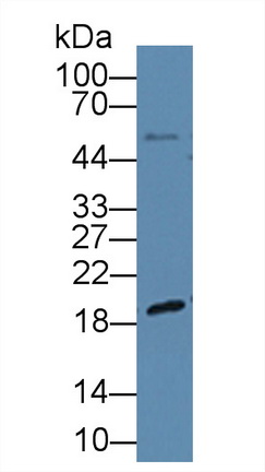 12658