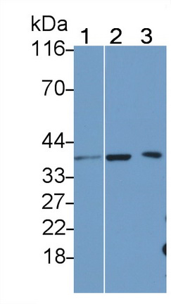 1531