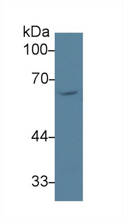 14246