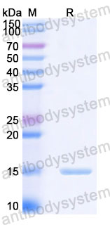 Валидация SDS-PAGE - AntibodySystem RHA05301